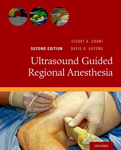 Ultrasound Guided Regional Anesthesia Ultrasound Guided Regional Anesthesia
