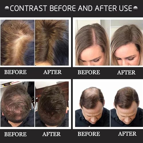 Hair Fibres Black, Thick Fiber Hair Fibres for Instant Thicking Hair Building Fibres For Men & Women - Image 4
