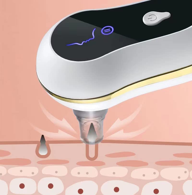 Gasin Electric Blackhead Instrument, Pore Cleaner Blackhead and Acne Can Remove Stubborn Blackheads and Effectively Shrink Pores (White