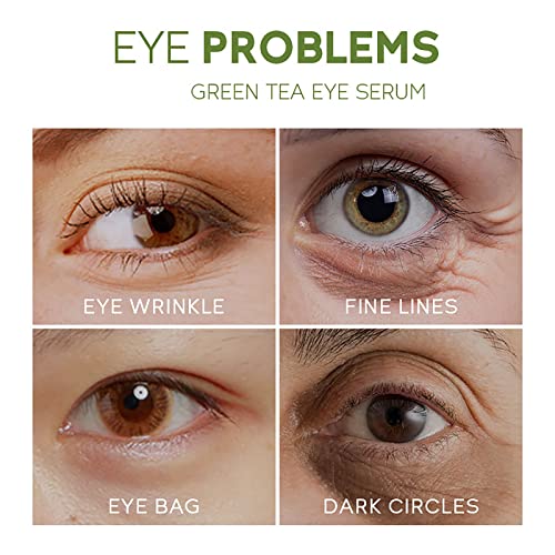 Akary Green Tea Eye Serum And Under Eye Roller Cream thumb #6
