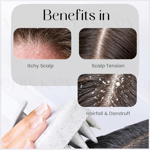 Image of Episkey Scalp Massager Shampoo Brush for Hair Wash Anti-Dandruff Silicone Scalp Scrubber with Soft Bristles | Deep Clean, Exfoliation & Hair Growth Ayurvedic Head Massage Brush for Men&Women(JW-35)