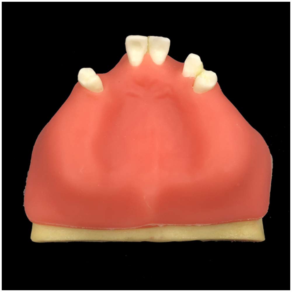 Sjdopulse A Implant Teeth Model - Teeth Demonstration Model - Suture Implant Nd Maxillary Sinus Lifting Training Model - Dental Teeth Study Teaching Model - For Science Education, Dentist Demonstration ( )