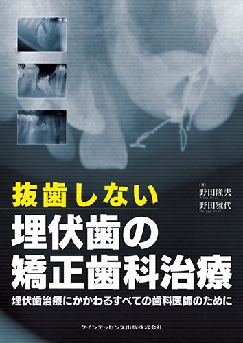 無料電子書籍アプリ 抜歯しない埋伏歯の矯正歯科治療 バイ