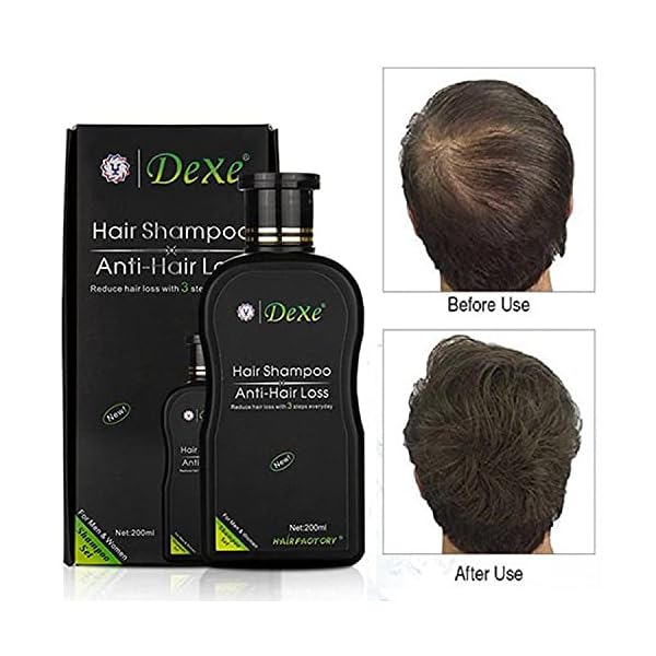 Signature Dexe Anti Hair Loss Shampoo 200 ML Hair Growth Treatment Care For Men & Women - Herbal All Natural - Fast…