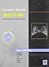 Specialty Imaging: Breast MRI: A Comprehensive Imaging Guide (Published by Amirsys®)