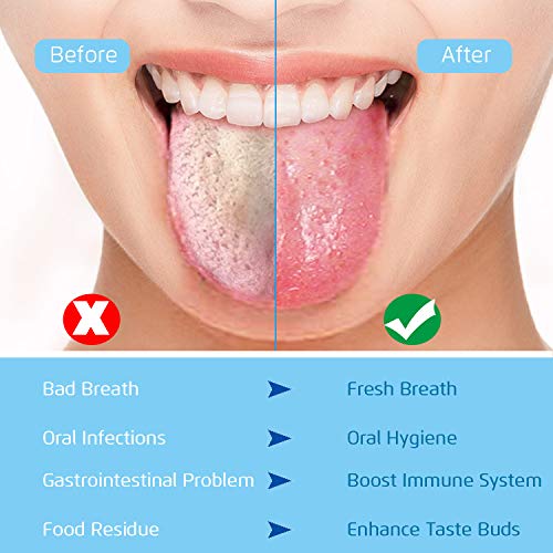 image for BUZHI 4PCS Tongue Scraper, Stainless Steel Tongue Cleaners, 100% BPA F