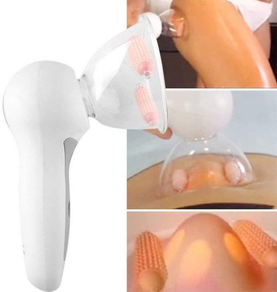 ZKK Masajeador Anticelulítico, Aspiradora, Salud Corporal Y Masaje De Belleza - USB - Blanco
