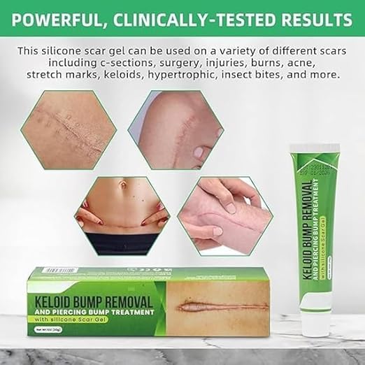 Image of Keloid & Scar Removal Gel - Advanced Silicone Scar Treatment Cream | Fades Acne, Surgery, Injury & Piercing Scars | Smoothens Skin, Reduces Bumps & Marks | 20g Scar Repair Solution (1)