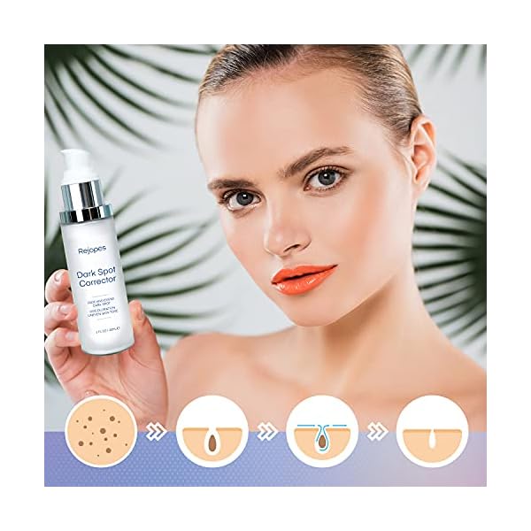 Dark-Spot-Remover-Dark-Spot-Corrector-Remover-for-Face-and-Body-Dark-Spot-Remover-with-Natural-Ingredients10-Fl-Oz REJOPES Dark Spot Remover, Dark Spot Corrector Remover for Face and Body, Dark Spot Remover with Natural Ingredients,1.0 Fl Oz, White, 1 Fl Oz (Pack of 1)