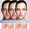 Dark-Spot-Remover-Dark-Spot-Corrector-Remover-for-Face-and-Body-Dark-Spot-Remover-with-Natural-Ingredients10-Fl-Oz REJOPES Dark Spot Remover, Dark Spot Corrector Remover for Face and Body, Dark Spot Remover with Natural Ingredients,1.0 Fl Oz, White, 1 Fl Oz (Pack of 1)