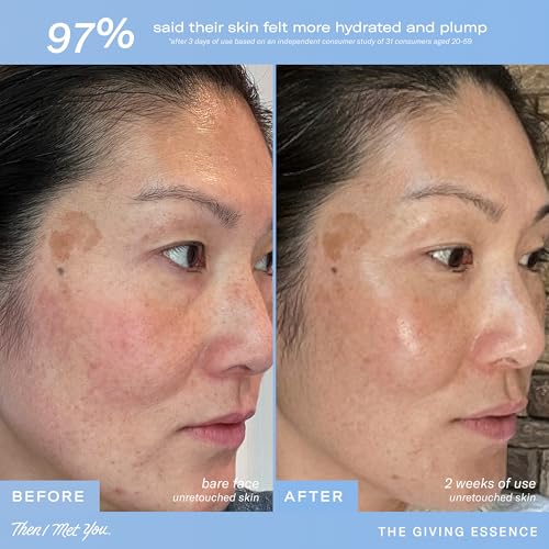 Then I Met You The Giving Essence, Vegan-Cruelty-Free Korean Skincare with 5% Niacinamide, Fermented Galactomyces, Red Algae & Berries for Brightening & Hydration, Suitable for All Skin Types, 5.07 oz - Image 7