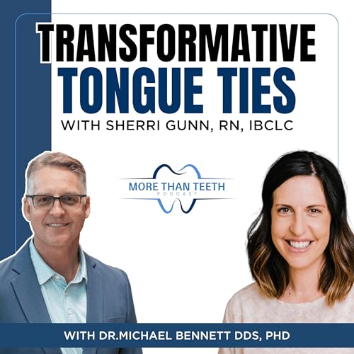 Transformative Tongue Ties: Uncovering Infant Health