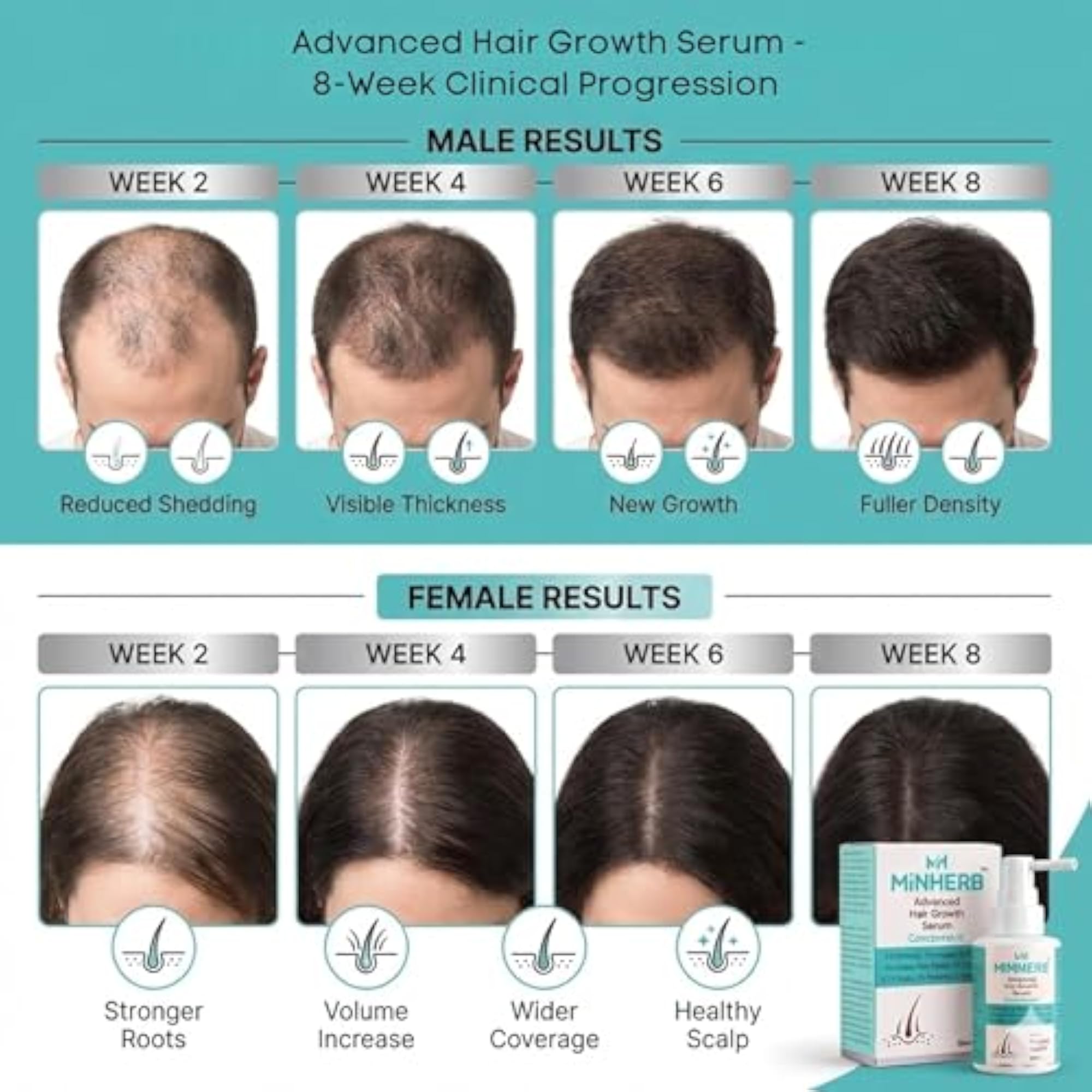 Advanced Hair Growth Serum Concentrate, Clinically Proven