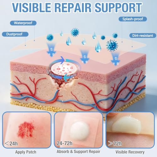 Image of Hydrocolloid Roll, Waterproof Bandage, Wound Dressing, Pimple Patch Roll