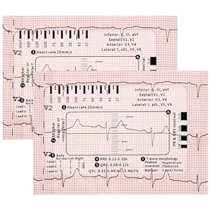 Regla de ECG, regla de ECG de 2 piezas con la interpretación de ECG/ECG de 7 pasos, herramienta de medición de ECG transparente, siga el plan en 7 pasos, para los estudiantes, el personal médico, 8,6