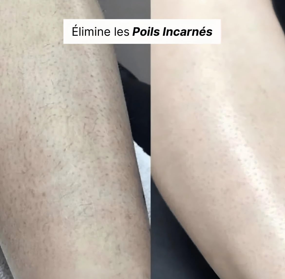 Rasoir Elios Femme 5 En 1, Rasoirs Électriques Femme, Epilateur Visage Femme avec Affichage, 5 têtes interchangeables Tondeuse Bikini 5 En 1 Étanche IPX7, Aisselles, Pour Bikini, Jambes, Nez (Blanc)