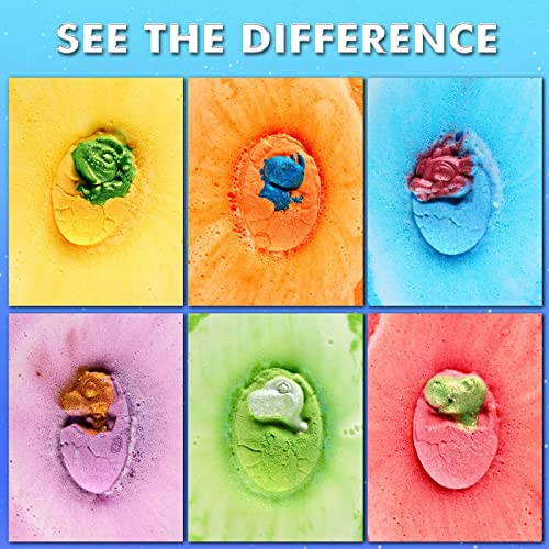 Dinosaur Bath Bombs For Kids - Xl Dino Egg Bath Bomb Gift Set, Natural Bubble Bath Kids, Fizz Spa Bathbombs Bath Balls Kit - Gift For Christmas Easter, Birthday Gift For Her Him Boys Girls Kids #TOP2