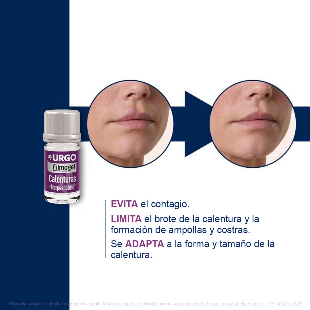 Urgo - Calenturas Filmogel® - Tratamiento para úlcera labial, para todas las etapas de la calentura - Alivia el picor, escozor y quemazón - Frasco de 3 ml con 24 aplicadores