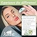 Keeva Organics Acne Treatment Cream With Secret TEA TREE OIL Formula - Perfect For Acne Scar Removal, Fighting Breakouts, Spots, Cystic Acne - See Results in Days Without Dry Skin (6oz)