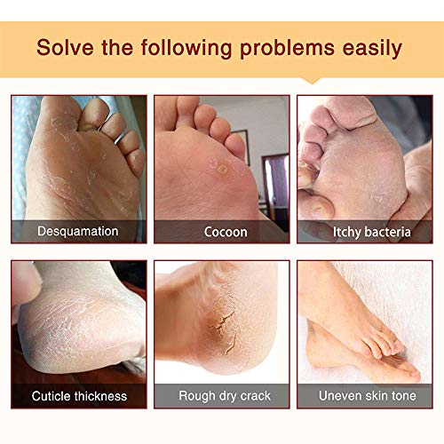 Foot Peel Mask 5 Pack, Lavender Exfoliant Foot Masks, Natural Peeling Away Calluses And Dead Skin Cells, Repair Rough Heels Foot Peel Gel Socks For Women Men #TOP5