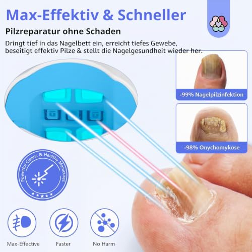 Saviland Upgrade Nagelpilz Laser Gerät Reinigungs, Nagelpilz Behandlung Schnell Intensiv...