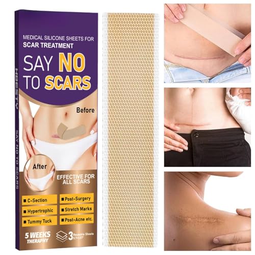 Derwrtup Hojas de Silicona para Cicatrices, Desvanecen Cicatrices Nuevas Y Antiguas, Tiras Recuperadoras De Quemaduras, Para Estrías Postquirúrgicas Cuidado de Abdominoplastía Queloides Quemaduras