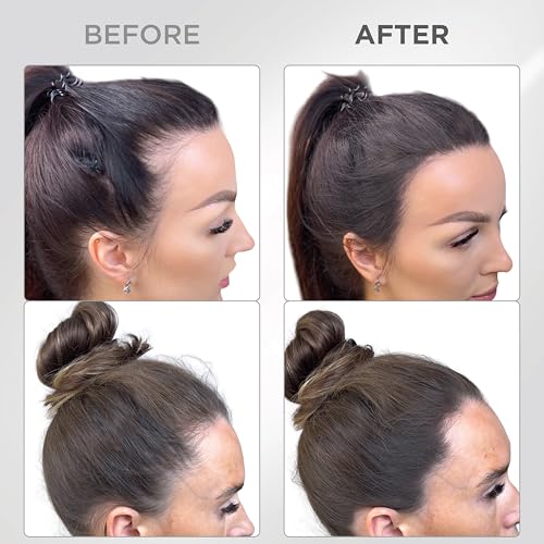 Image of THICK FIBER Root Touch Up & Hairline Powder with Precise Brush for Grey Root Coverage & Thin Hair (Dark Brown, 4g) - Water & Sweat Resistant - Hair Loss Concealer for Women, Bald Spots & Hair Fill-In