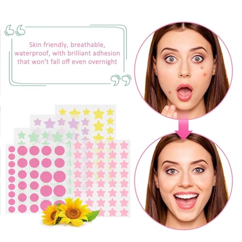 185 Stück Pickel Patch Sterne und Runde Pimple Patches mit Teebaumöl + Salicylsäure + Centella für Akneflecken Pickel Whiteheads Pickel Grün Gelb Rosa