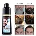 Men's Mustache & Beard Dye for Gray Hair Coverage - Natural Black Color in 5 Minutes, Easy Application Shampoo for Facial Hair 200ml