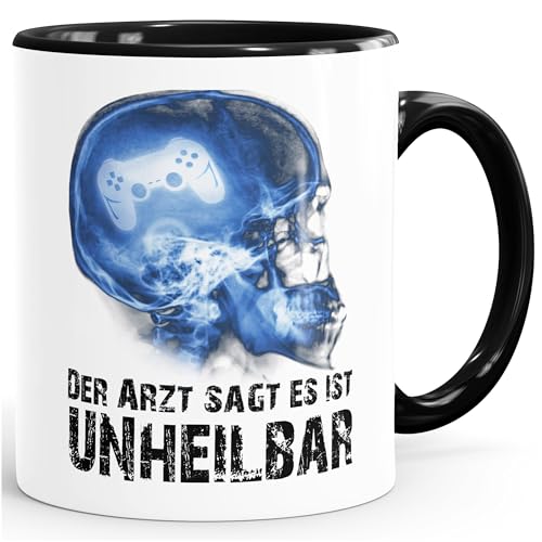 Moonworks® Kaffee-Tasse Xray Der Arzt sagt es ist unheilbar Hobby Röntgenbild Schädel Controler Joypad Playstation Zocken Gamer schwarz unisize