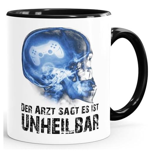Moonworks® Kaffee-Tasse Xray Der Arzt sagt es ist unheilbar Hobby Röntgenbild Schädel Controler Joypad Playstation Zocken Gamer schwarz unisize