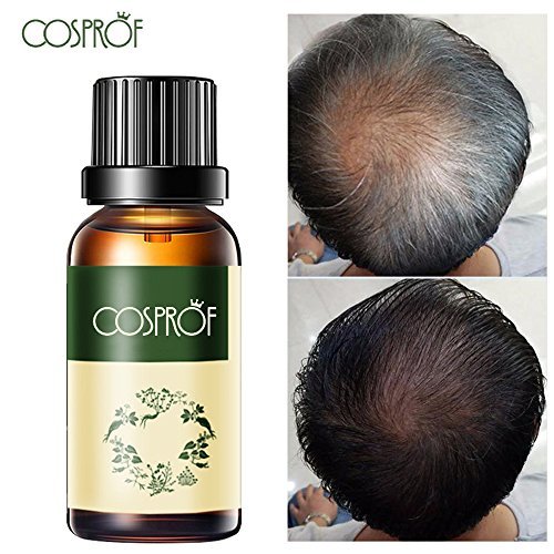 Cosprof Hair Growth Essence Oil Professional Salon Hairstyles Keratin Hair Care, Anti Hair Loss Dense 30ml