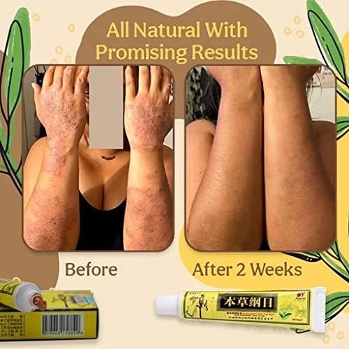 (Effective and Safe) 6 Pack Natural Chinese Herbal Cream, Eczema Psoriasis Moisturizing Creams for Body & Face, Anti-Itch Skincare Cream, External Use Only (90g) - Image 2