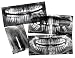 Roylco R-59269 Dental X-Rays, Set of 17