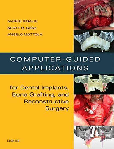 Computer-Guided Applications For Dental Implants, Bone Grafting, And Reconstructive Surgery (Adapted Translation) #TOP6