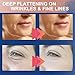 Akissos Forehead and Between Eyes Wrinkle Patches The Original Wrinkle Patch Non Invasive Wrinkle Smoothers for Forehead Wrinkles 5cm width