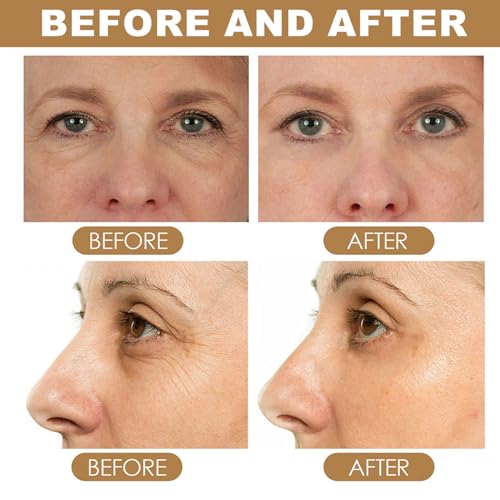 Grospe Retinol Eye Cream Stick Anti Wrinkle Eye Cream,2Pcs Retinol Eye Stic With Collagen,Hyaluronic Acid,Instant Firmx Eye Skin For Puffy Eyes,Dark Circles,Eye Bags,Crows Feet,Wrinkles thumb #5