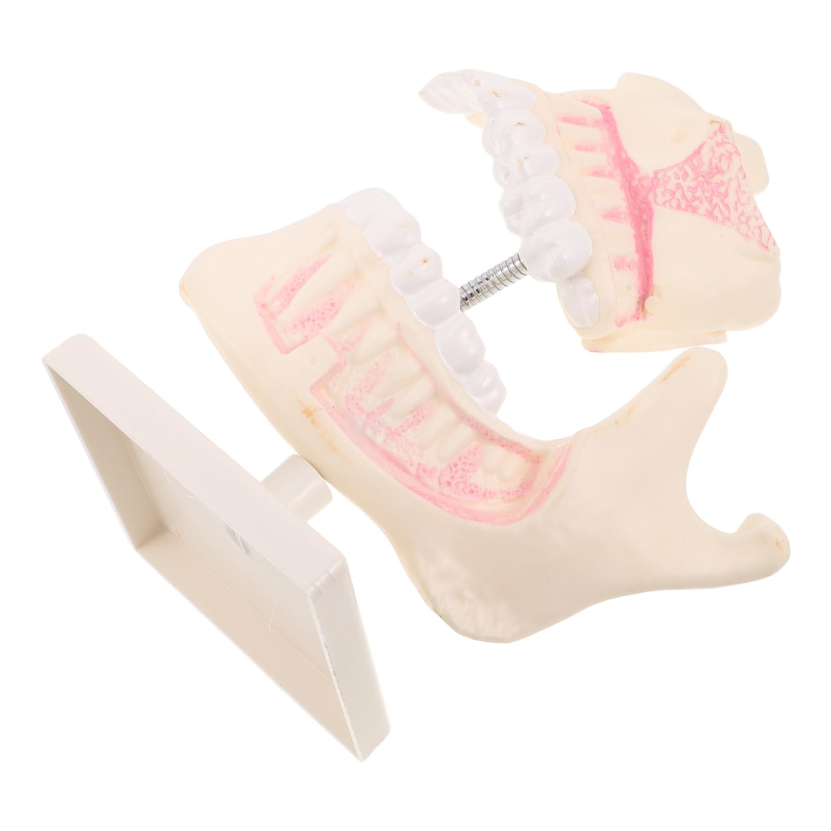 Overdenture Modell Kieferorthopädisches Übungsmodell Zahnersatzreparatur Übungszahnmodell Dekor Skulptur Zahnschnitz Trainingsmodell Zahnschnitz Übungsmodell Kunststoff
