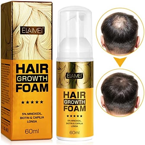 5% Minoxidil Foam for Men & Women Hair Regrowth Treatment, Keeps Hair Regrowth, Stop Hair Loss and Thinning, Helps Hair Growth, Promotes Hair Follicle Growth, Mild Non-irritating Formula, 2.11fl oz