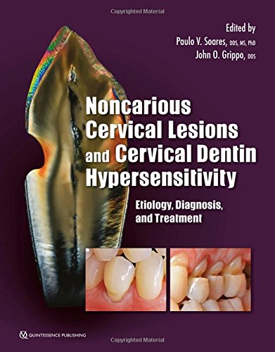 Buy Noncarious Cervical Lesions and Cervical Dentin Hypersensitivity: Etiology, Diagnosis, and Treatment — BookShops.in
