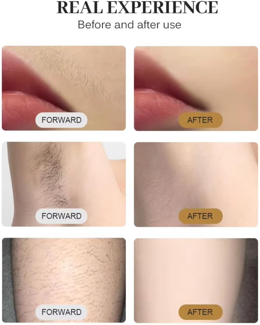 Salon Beauty Device for Men Women, Body Hair Removal Machine, Facial Rejuvenation for Fine Lines, Speckles