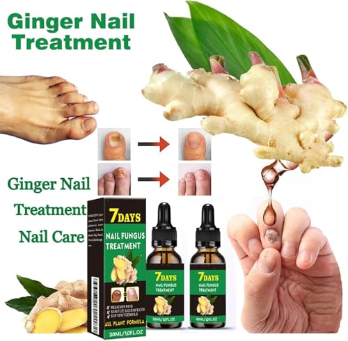 Opiniones y reviews de Desenterrador de uñas Top 5. 29 Imagen adicional