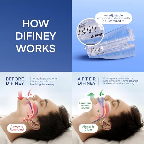 anti snoring device - d4