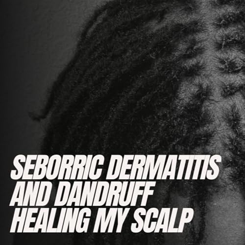 Seborrheic Dermatitis and Dandruff: Healing my Scalp | Unlock Your Inner Healer