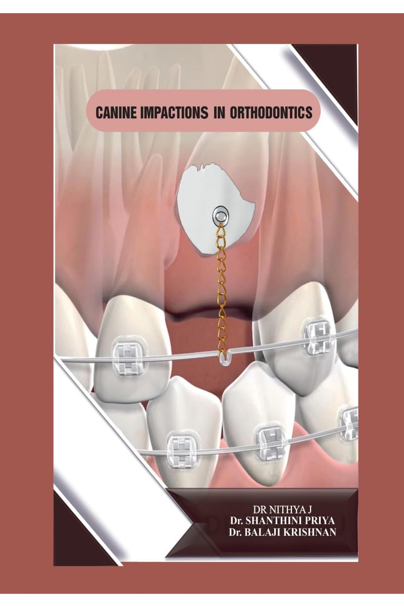 Canine Impactions in Orthodontics