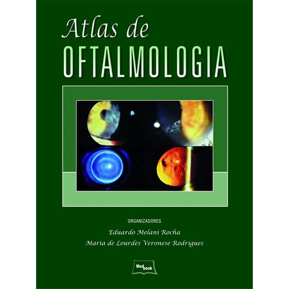 Atlas de Oftalmologia | Amazon.com.br