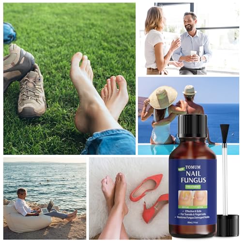 Toe finger nail fungal treatment: hongos fungal remover extra strength liquid - repair damaged nail with brush (30ml/1fl oz) - Thumbnail 6
