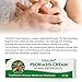 Psoriasis Cream, Psoriasis Treatment, Seborrheic Dermatitis Cream, Chinese Herbal Ointment for Psoriasis, Dermatitis, Eczema and Pruritus, 20g