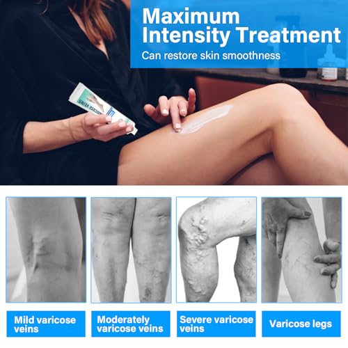 Justswag Varicose Veins Treatment For Legs, Varicose Veins Cream With Mild Ingredients thumb #4