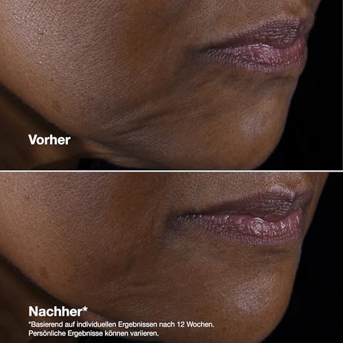 Smart Clinical Repair™ Lifting Face + Neck Cream | Mit 9% Peptiden + Hyaluronsäure | Anti-aging + feuchtigkeitsspendend – Ansicht 5